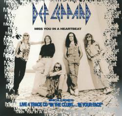Def Leppard : Miss You in a Heartbeat (Acoustic)